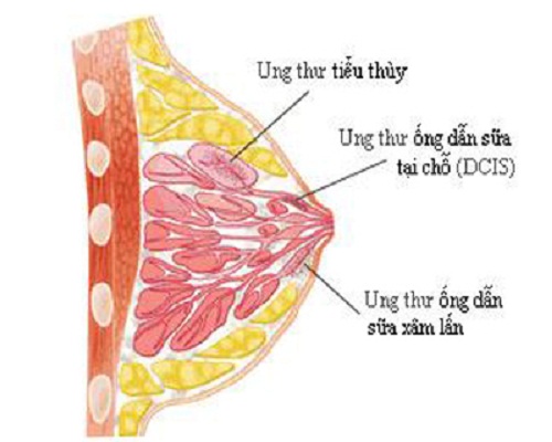 Bồ Công Anh loài hoa có tác dụng phòng chống ung thư