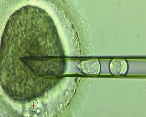 Kỹ thuật thụ tinh nhân tạo lấy DNA “3 người” được chứng minh an toàn